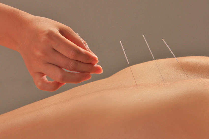 Akupunktur, Akupunktur TCM, Akupunktur Pulsnitz